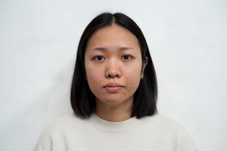 girl 1 before