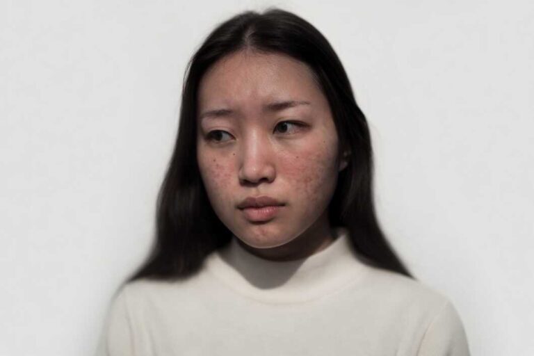 girl 2 before